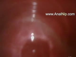 Sweet jap anal hairy sex video